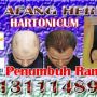 HARTONICUM PENUMBUH RAMBUT TERCEPAT | 081311148990