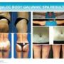 Galvanic Body TRA Set Free OMRON Weight Analyzer